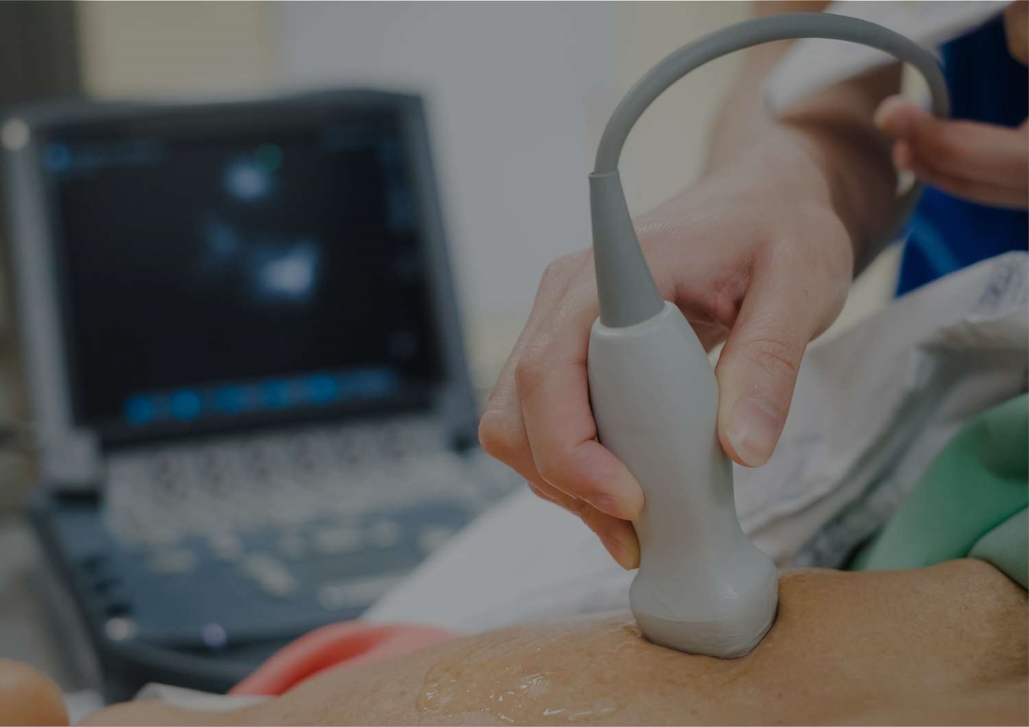 Echocardiogram (ECHO) Echocardiogram (ECHO)